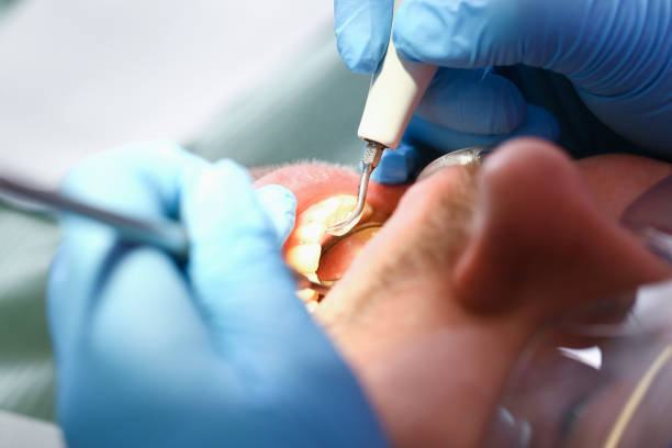 Best Emergency Dental Services for Seniors in Rockwall, TX